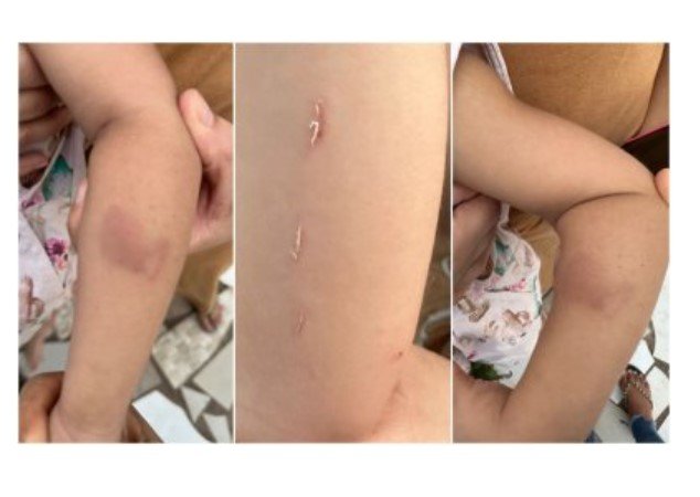 Menina autista é maltratada em creche e mãe registra B.O na capital do estado.