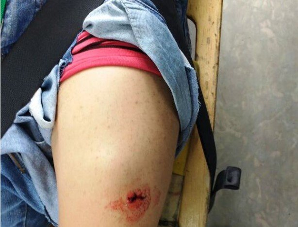 Ladrão em Colíder parte para cima de polícia e leva tiro; o mesmo estava furtando comércios na cidade.