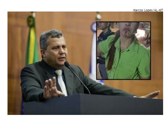 Ex-deputado é denunciado pelo MPE após agredir a esposa