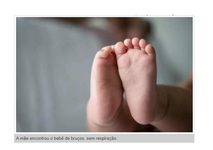 Mãe em Carlinda procura a PM após filha de 1 ano apresentar hematoma na região genital depois de visita ao pai