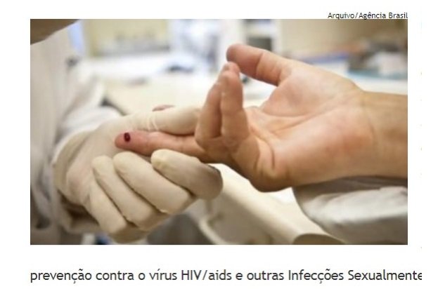 Casos de sífilis e de HIV/aids aumentam entre homens jovens