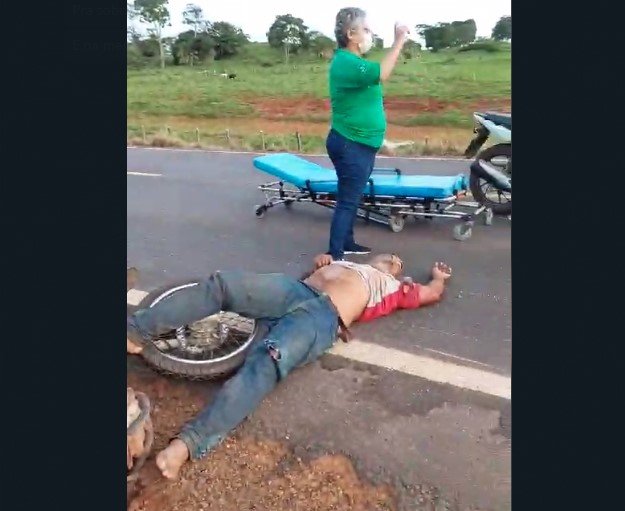 COLÍDER: Gravíssimo acidente na MT-320, deixa dois motociclistas feridos a mulher com traumatismo craniano e o homem com braço quebrado. (Vídeo)