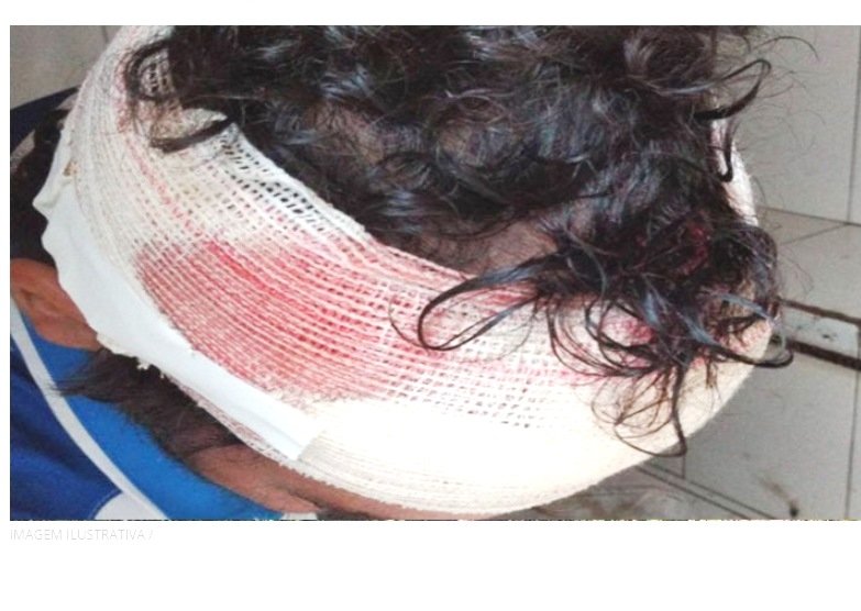 COLÍDER: Mulher agredida dá pauladas na cabeça do seu ex-marido, e ele acaba preso.