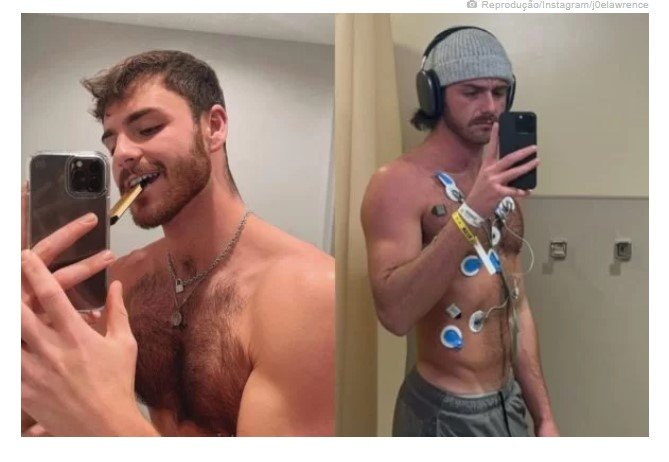 Aos 25, jovem que usava vape diariamente fica com 'buraco' no pulmão