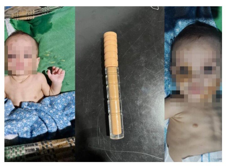 Vera: Juiz solta mãe, que espancou bebê de 1 ano, usou maquiagem para esconder 'roxos' e foi pega transando na frente do filho
