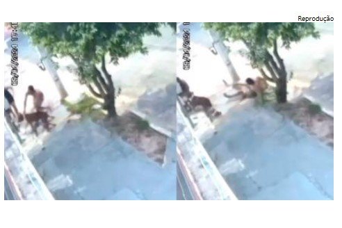 Criança de dois anos é atacada por Pitbull na frente de casa