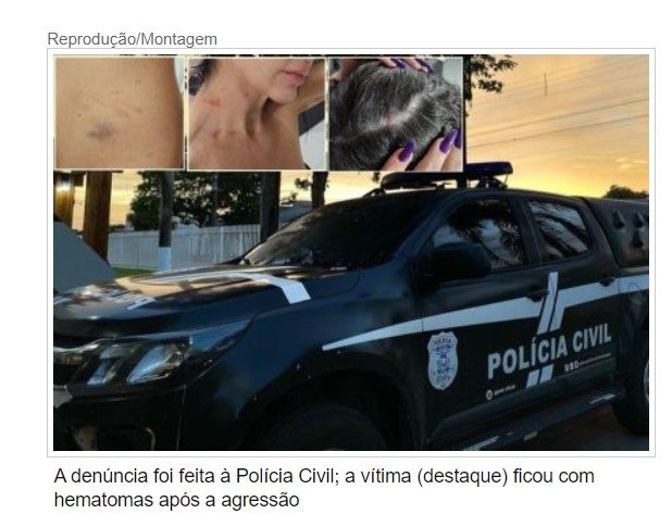 Servidora diz que apanhou de cassetete de mulher de policial