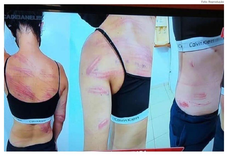 COLÍDER: Jovem leva ‘Salve’ de mulheres faccionadas com balaclavas.