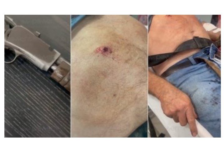 Com rifle calibre 22, idoso atira sem querer na própria barriga em MT