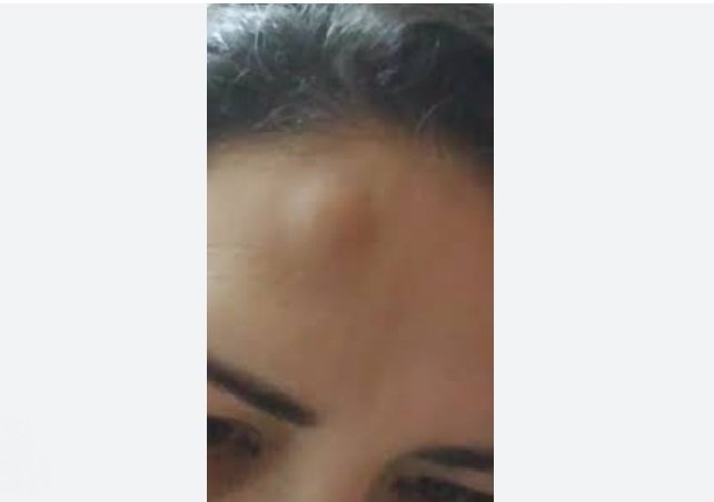 COLÍDER: Filho vai preso após agredir Mãe acertando celular na testa dela.