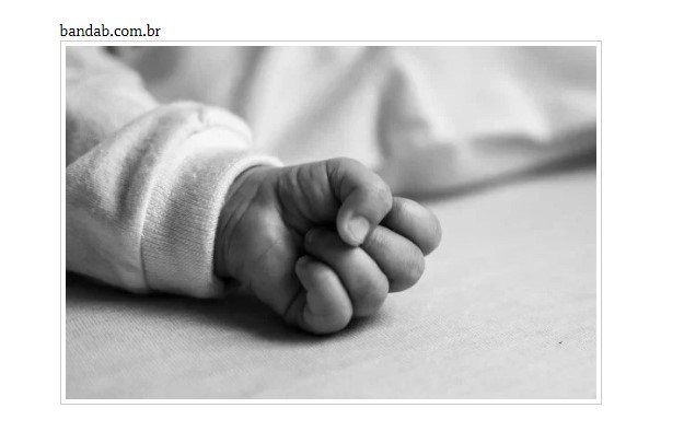 Bebê de um ano é internado com sinais de abuso em MT