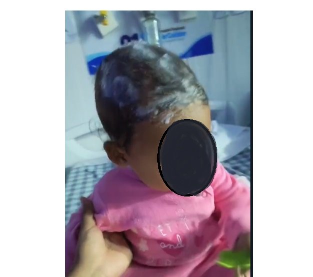 URGENTE: Bebe de apenas 6 meses fica ferida em explosão de transformador no aniversário de NSH/MT. (Video)