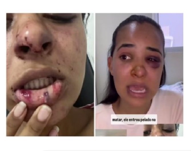 Mulher revela como escapou de estuprador e o esfaqueou em MT