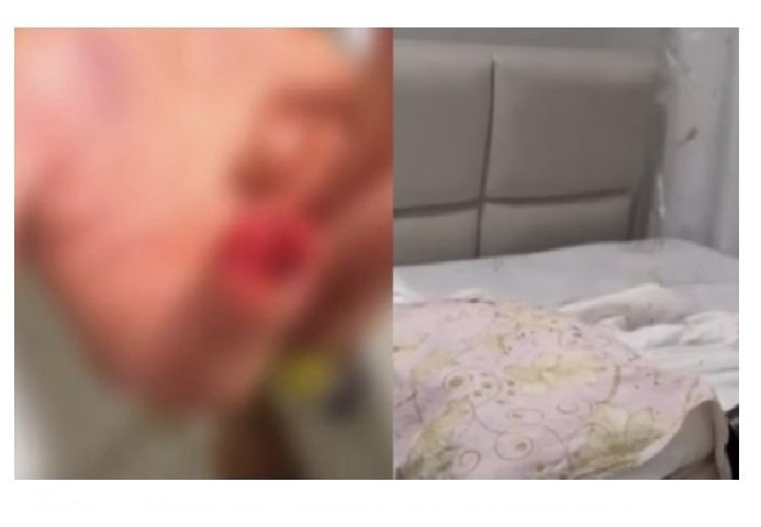 SINOP: Médico invade casa da ex e mutila atual namorado dela.