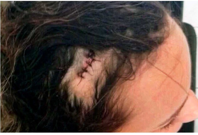 COLÍDER: No meio da noite gestante e agredida pelo Marido, e ele acaba fugindo em seguida.