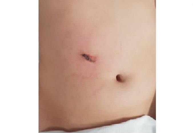 COLÍDER: Adolescente denuncia sua Mãe por maus tratos e ser espancado por ela.