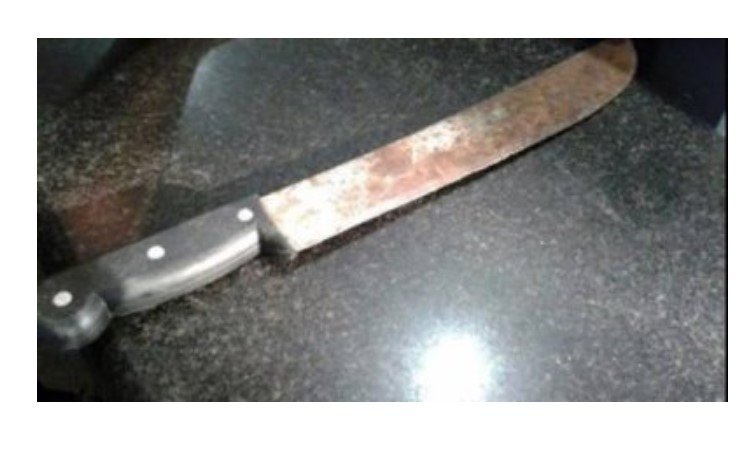 Maníaco usa facão para espancar esposa e a golpeia nas mãos