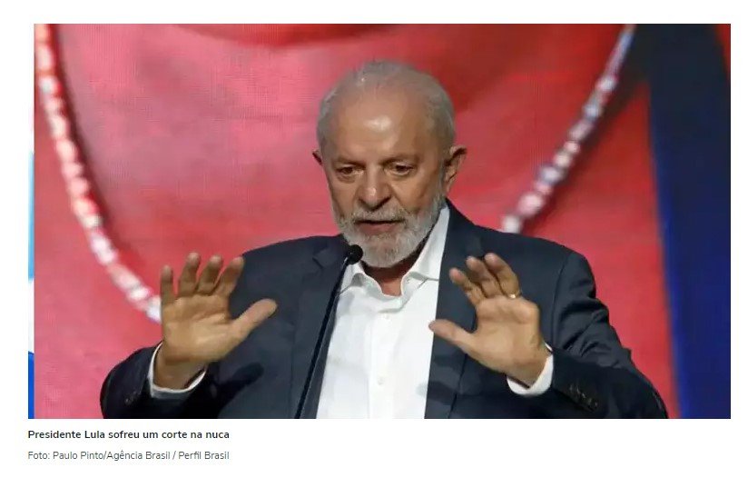 Queda no banheiro, corte na cabeça e pontos: saiba como foi o acidente doméstico de Lula que o fez cancelar viagem à Rússia