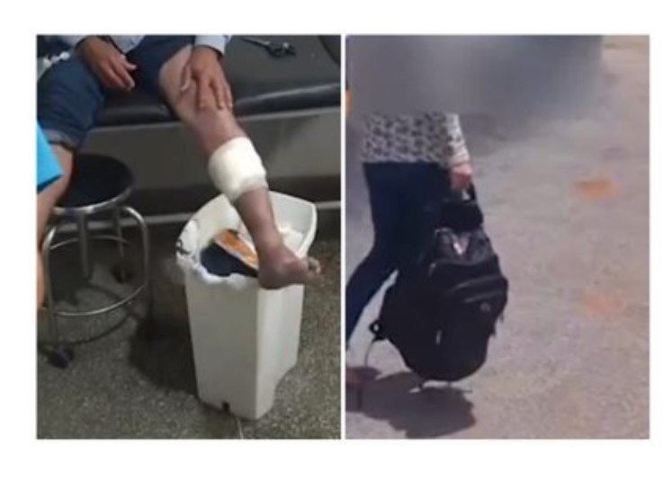 Garimpeiro é seduzido por novinha, roubado e baleado em MT