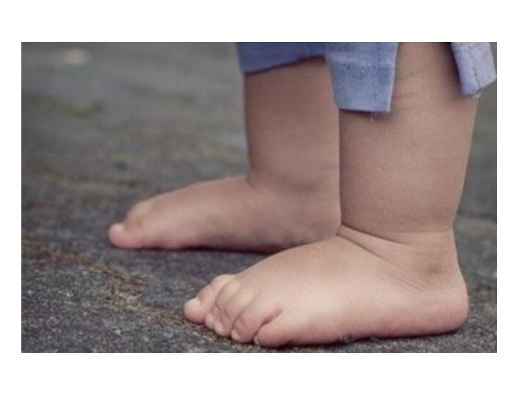 Bebê de apenas 1 ano morre ao se engasgar em cidade de MT