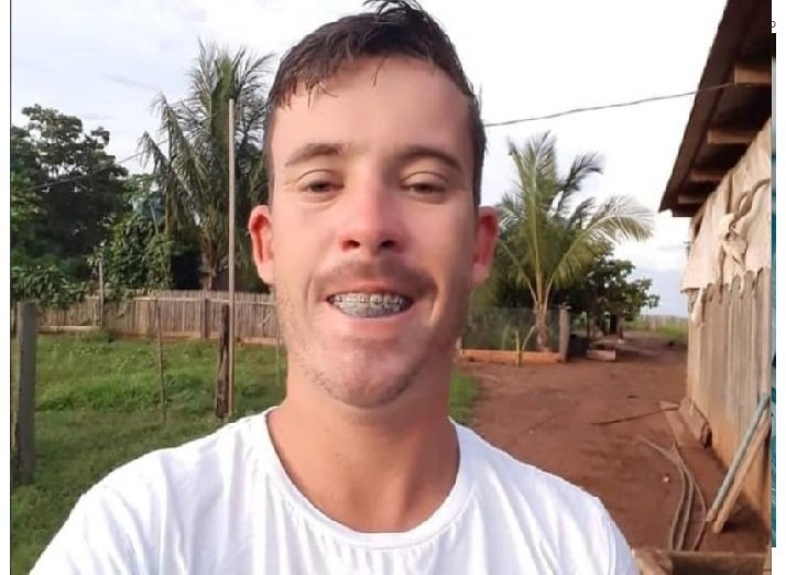 SINOP: Vítima de acidente não resiste e morre após 5 dias internado.