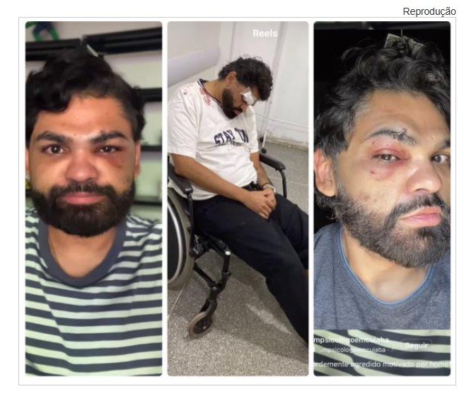 Psicólogo é agredido dentro de boate na capital e denuncia crime de homofobia