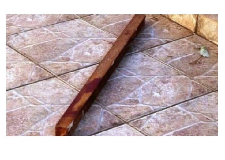 Jovem de 20 anos é preso depois abrir supercílio de companheira 'na paulada'