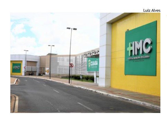 Idosa com queimaduras pelo rosto e corpo morre no HMC