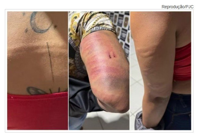Garotas de programa são torturadas após confusão em boate de MT