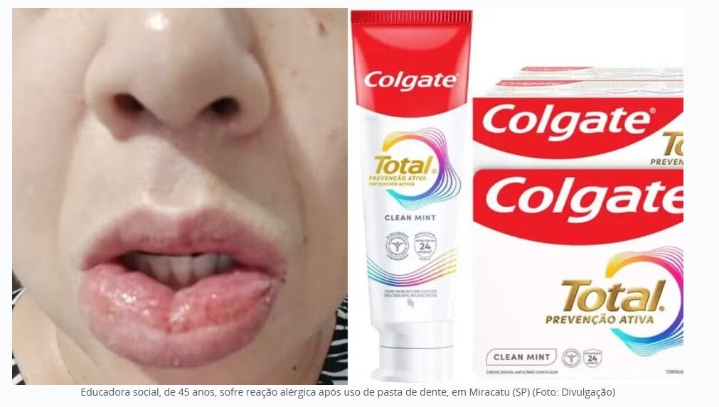 Pasta da Colgate com venda proibida causa reações adversas a mais de 1,2 mil pessoas