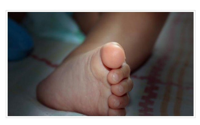 Bebê de 1 ano com deficiência morre após passar mal