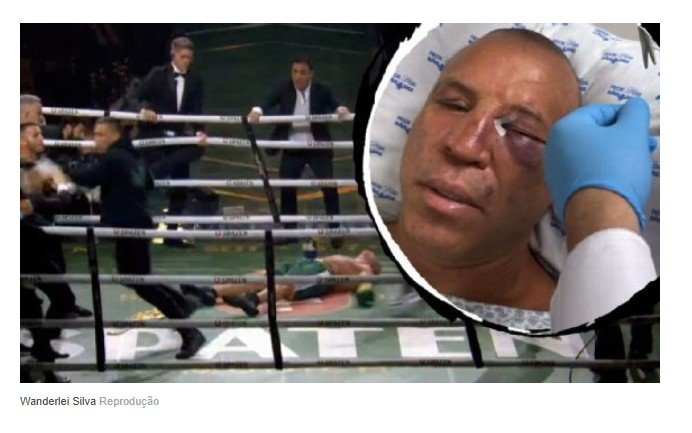Pontos e nariz quebrado: veja o estado de Wanderlei Silva após briga generalizada e luta com Popó'
