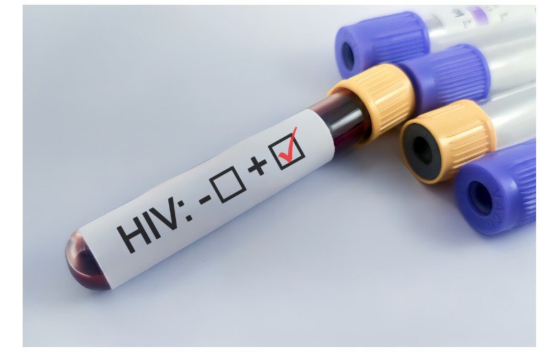 Descoberta histórica pode ser início do fim do HIV: cientistas alemães encontram anticorpo capaz de neutralizar quase todas as variantes do vírus