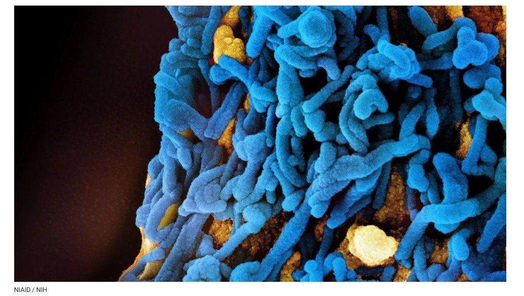 País africano confirma surto de vírus altamente letal da família do ebola