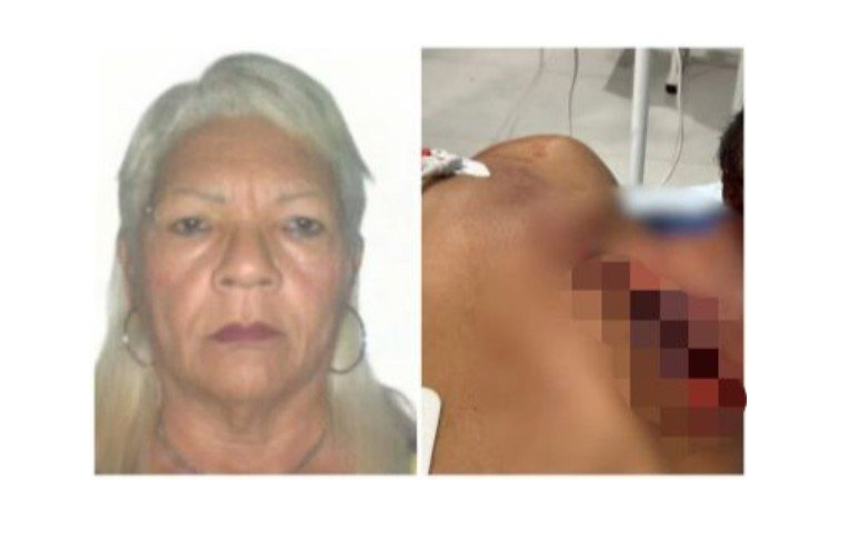 Mulher que esfaqueou namorado por falta de sexo tem dobro da idade em MT