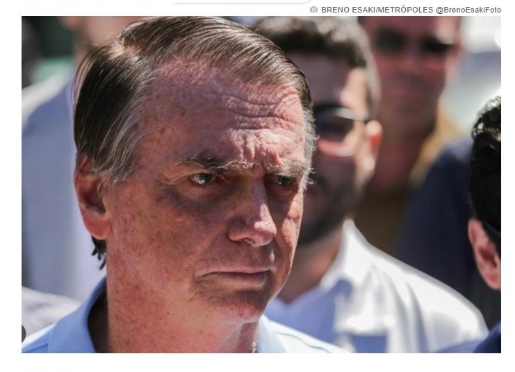 Médicos atualizam estado de saúde de Bolsonaro após cirurgia
