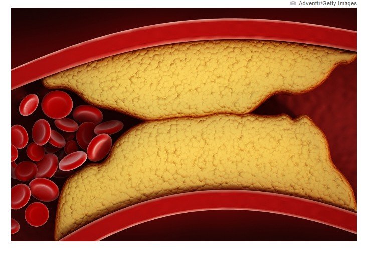 Médico vascular aponta as melhores vitaminas para a saúde das artérias