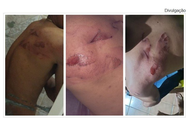 NOVA GUARITA: Trabalhadores são espancados com facão e ameaçados por patrões armados em alojamento