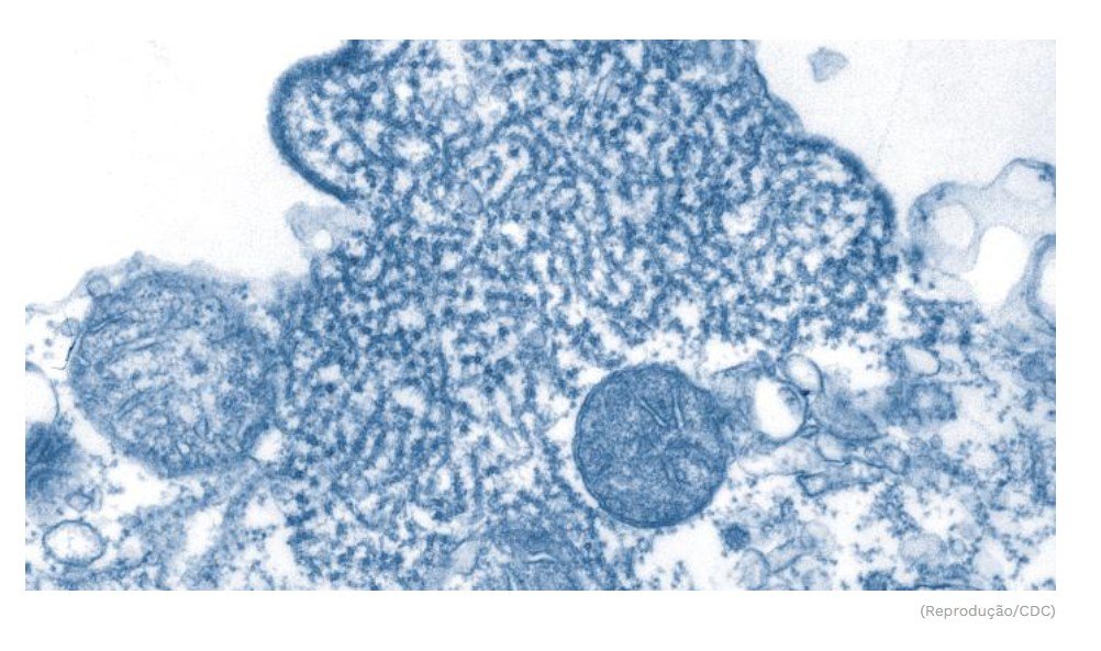 Ministério da Saúde faz comunicado sobre o Vírus Nipah no Brasil após o Carnaval