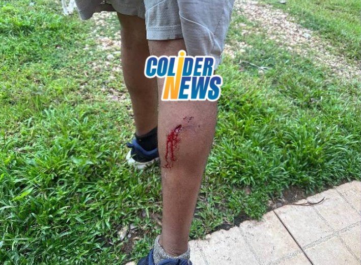 Homem em Colíder e atacado por cadela da raça PitBull
