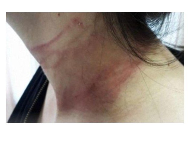 Garota marca programa e acaba dopada e enforcada em MT
