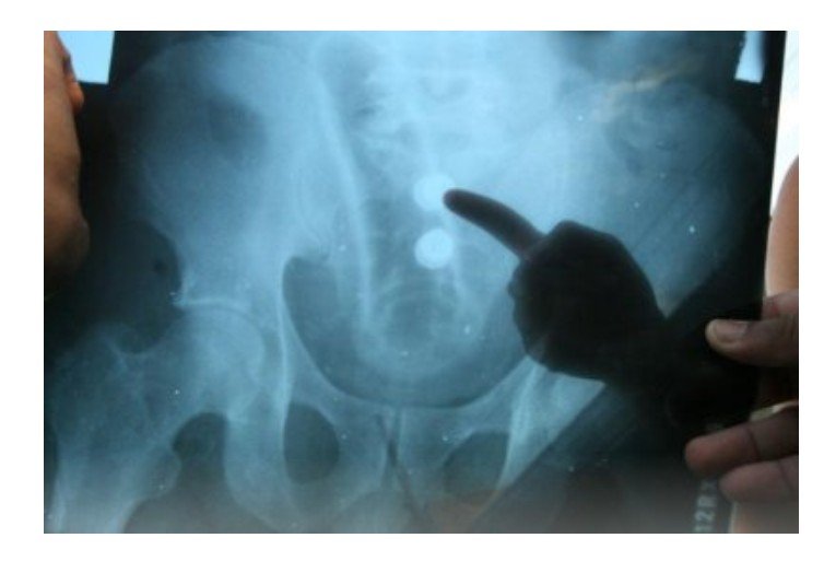 Homem ousa em noite de prazer e fica com vibrador no ânus em MT