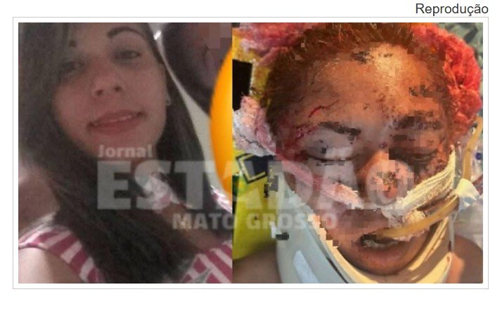 Usuária morre após ser espancada por mulher em briga por drogas em Cuiabá