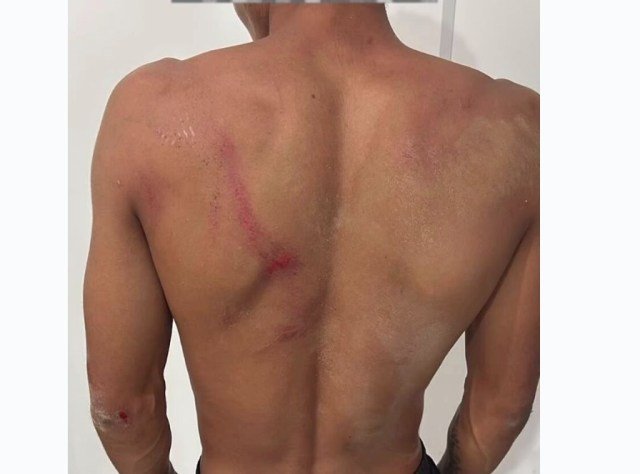 Homem escapa da morte após ser torturado em 'Salve de Facção' em MT.