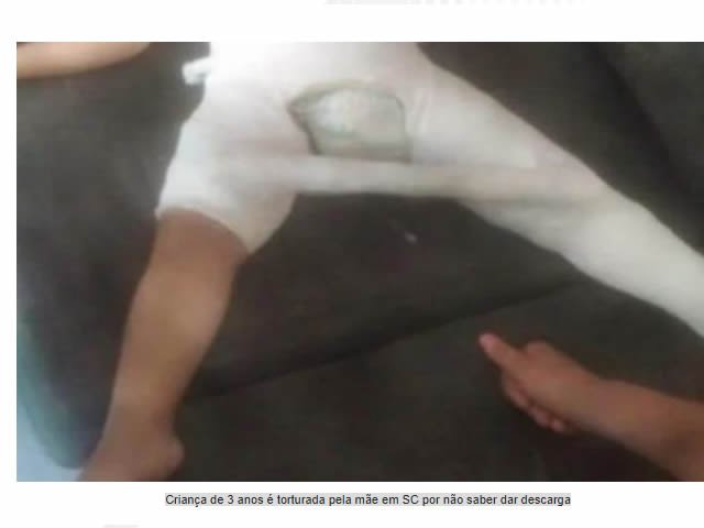 Mãe é presa por quebrar perna da filha de 3 anos que não conseguiu acionar descarga