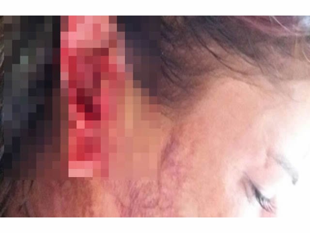 Mulher tem orelha cortada em briga e três acabam presos