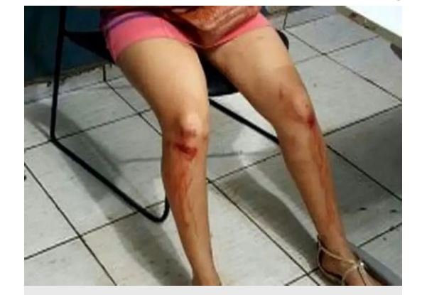 Mulher é espancada por cinco pessoas ao ser apontada como ‘bruxa’