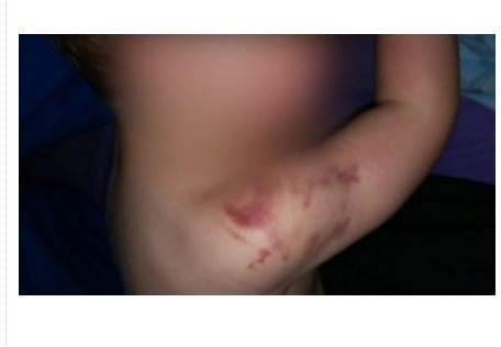 Professor é suspeito de agredir bebê em creche