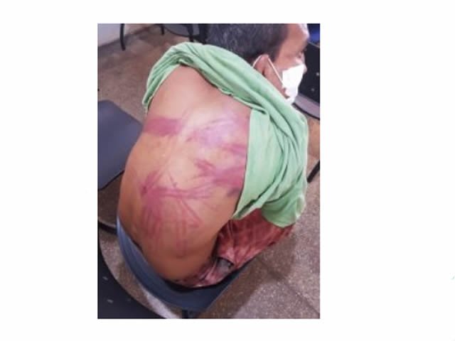 Homem é espancado e diz ter levado 'salve' por engano em MT