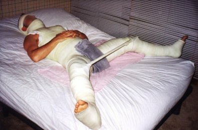 Mulher é presa após tentar arrancar o pênis do marido com tesoura